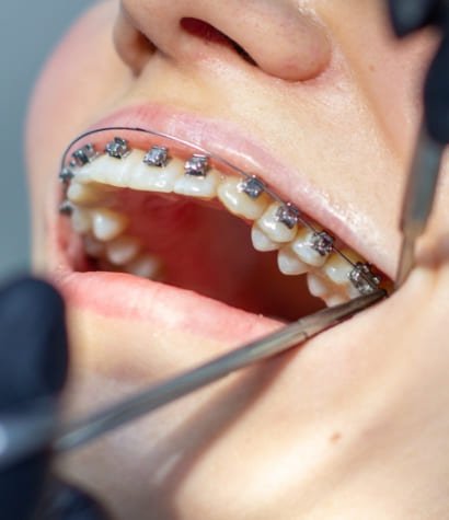 Ortodoncia y ortopedia